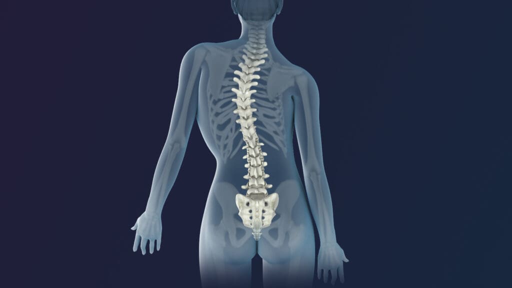 "Unlock Your Potential: The Impact of Personal Training on Scoliosis | Personal Training "